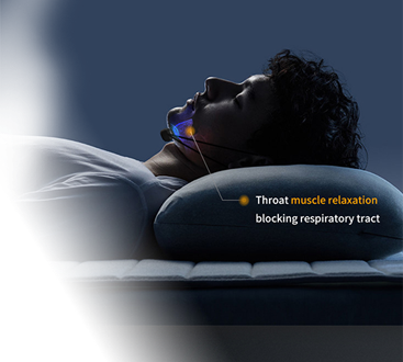 SCOBUTY Anti Snoring Device SCAM - NSFE Talkback - Sellers Ask